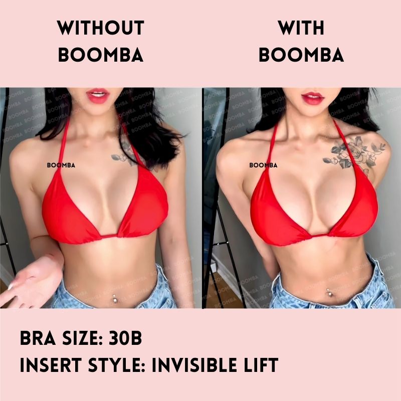 Invisible Lift Inserts®
