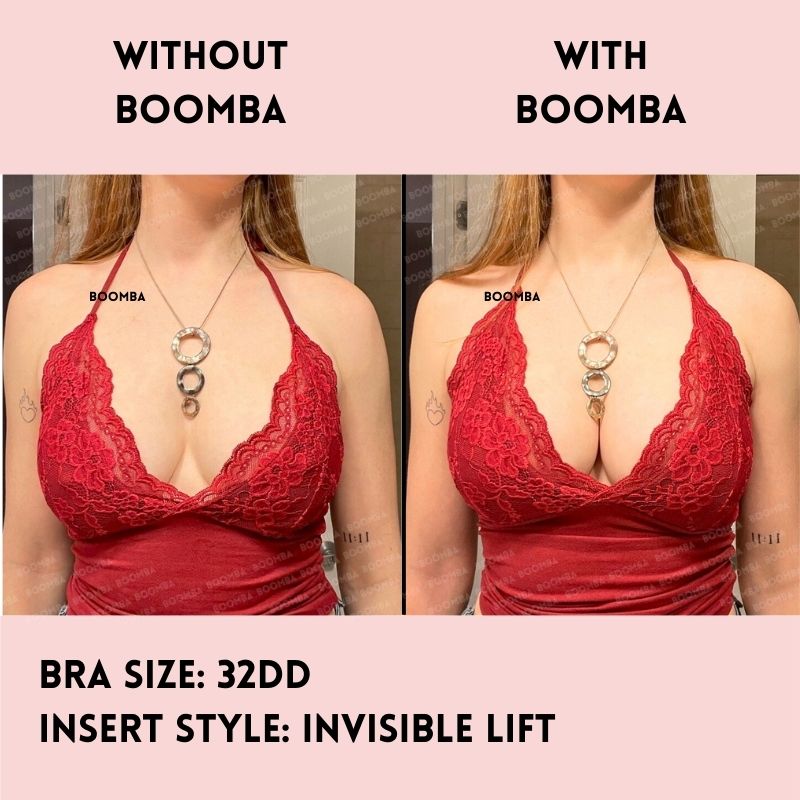 Invisible Lift Inserts®